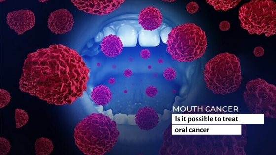 Mouth cancer treatment